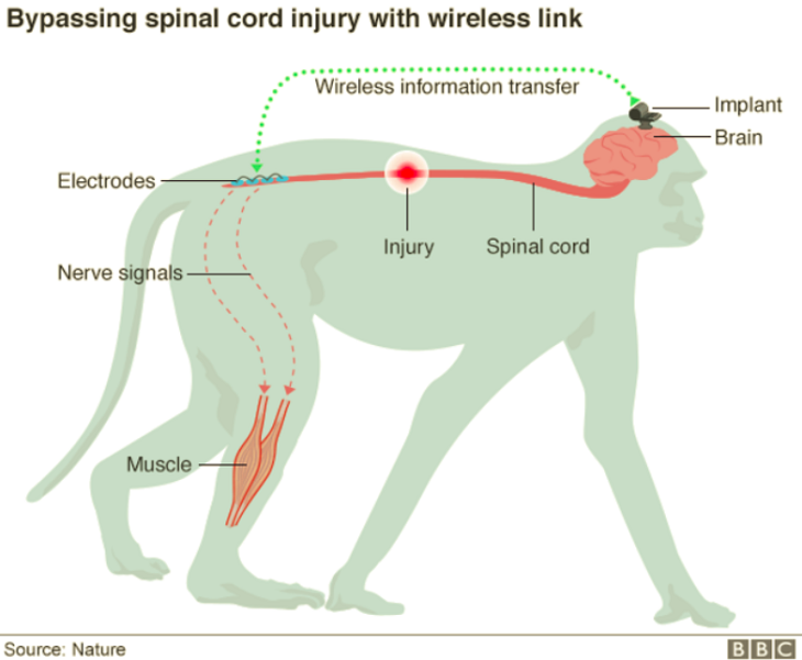 Brain wifi gives monkeys use of paralyzed limbs
